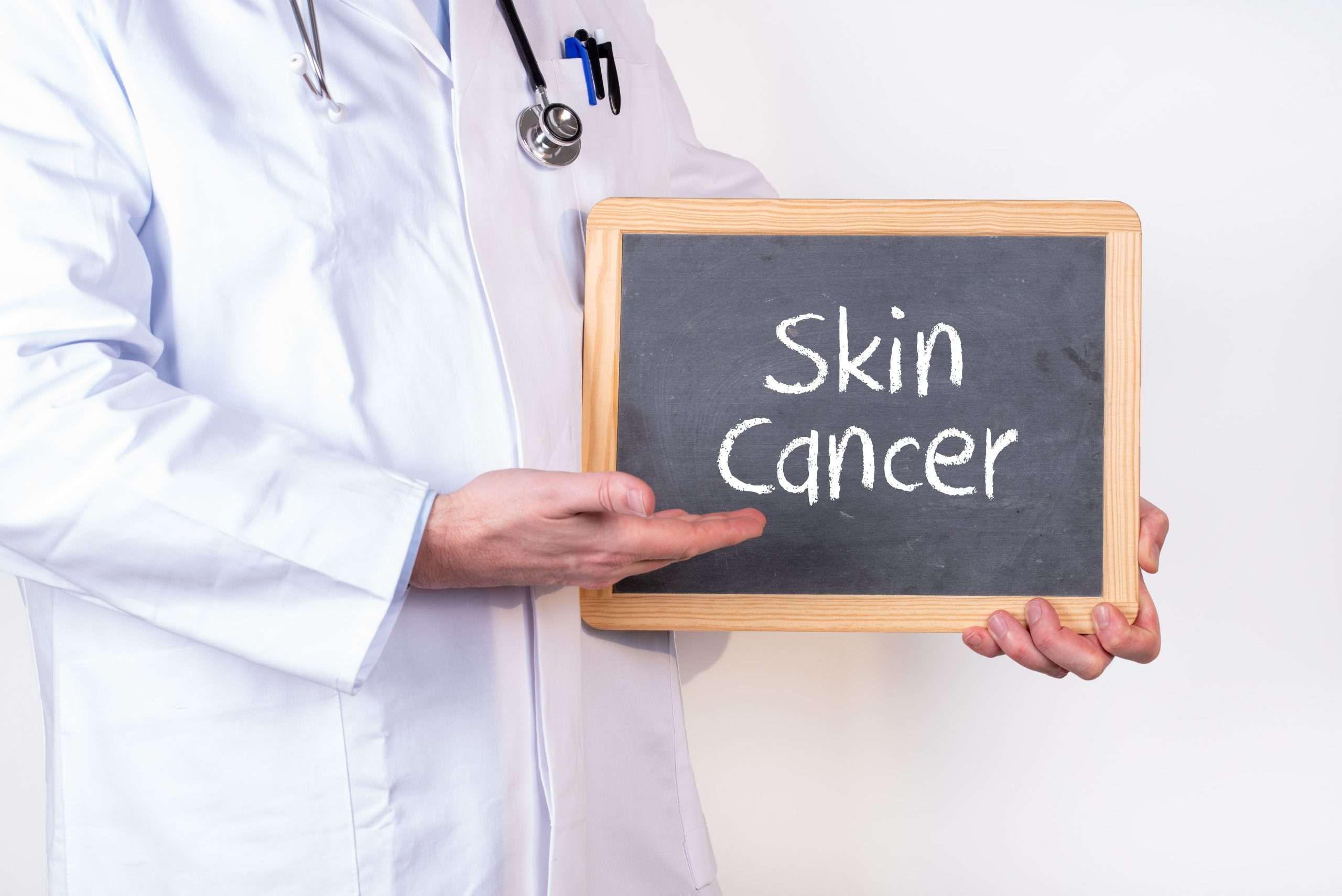 select the most correct statement concerning skin cancer